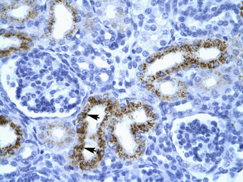 SERPINF1 Rabbit Polyclonal Antibody