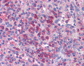 PRDM1 Rabbit Polyclonal Antibody