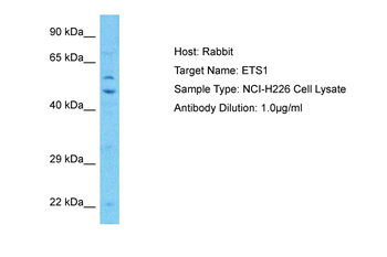 ETS1 Rabbit Polyclonal Antibody