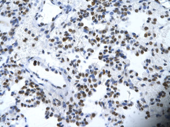 ETS1 Rabbit Polyclonal Antibody