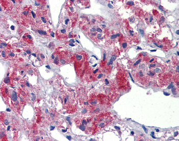 TAL1 Rabbit Polyclonal Antibody