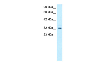 TAL1 Rabbit Polyclonal Antibody