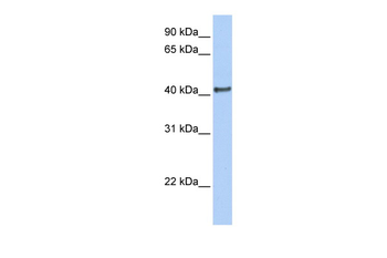 DMRT1 Rabbit Polyclonal Antibody