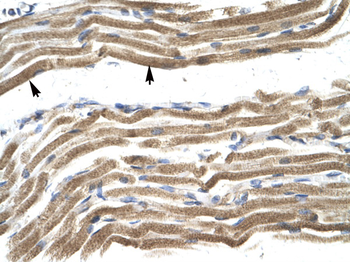 HOXA10 Rabbit Polyclonal Antibody