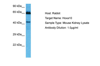 HOXA10 Rabbit Polyclonal Antibody