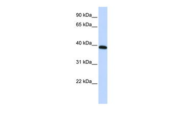 HOXA10 Rabbit Polyclonal Antibody