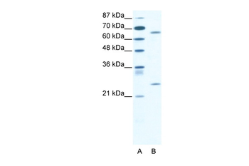 FOXK2 Rabbit Polyclonal Antibody