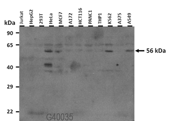 SOX9 Rabbit Polyclonal Antibody