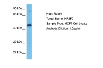 NR2F2 Rabbit Polyclonal Antibody