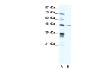 NFIC Rabbit Polyclonal Antibody
