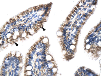 TFDP1 Rabbit Polyclonal Antibody