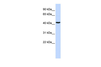 GATA1 Rabbit Polyclonal Antibody