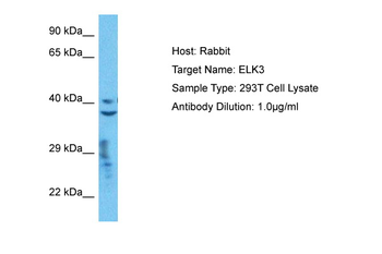 ELK3 Rabbit Polyclonal Antibody