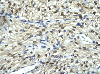 FLI1 Rabbit Polyclonal Antibody