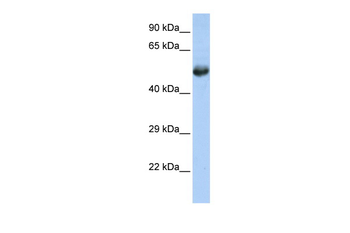 FLI1 Rabbit Polyclonal Antibody