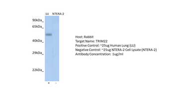 TRIM22 Rabbit Polyclonal Antibody