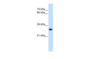 TAL1 Rabbit Polyclonal Antibody