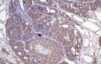 Multi-rAb Polymer HRP-Goat Rabbit Recombinant Secondary Antibody (H+L)
