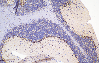 Multi-rAb Polymer HRP-Goat Rabbit Recombinant Secondary Antibody (H+L)
