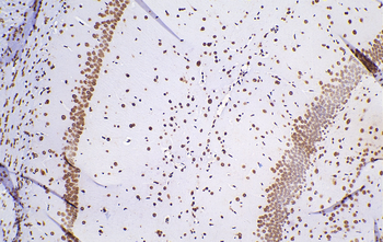 Multi-rAb Polymer HRP-Goat Rabbit Recombinant Secondary Antibody (H+L)