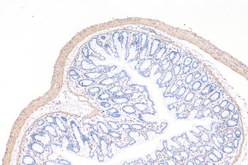 Multi-rAb Polymer HRP-Goat Rabbit Recombinant Secondary Antibody (H+L)