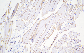 Multi-rAb Polymer HRP-Goat Rabbit Recombinant Secondary Antibody (H+L)
