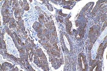 Multi-rAb Polymer HRP-Goat Rabbit Recombinant Secondary Antibody (H+L)