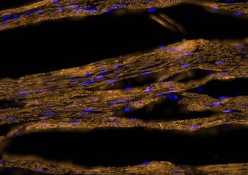 Multi-rAb CoraLite Plus 555-Goat Mouse Recombinant Secondary Antibody (H+L)