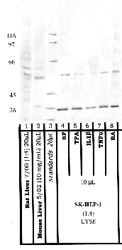 Anti-MBTPS1 Rabbit Polyclonal Antibody