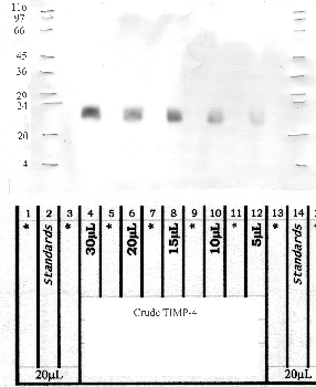 Anti-TIMP4 Rabbit Polyclonal Antibody