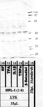 Anti-MMP24 Rabbit Polyclonal Antibody