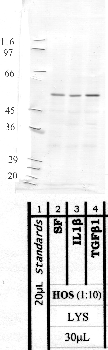 Anti-MMP8 Rabbit Polyclonal Antibody