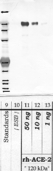 Anti-ACE2 Rabbit Polyclonal Antibody