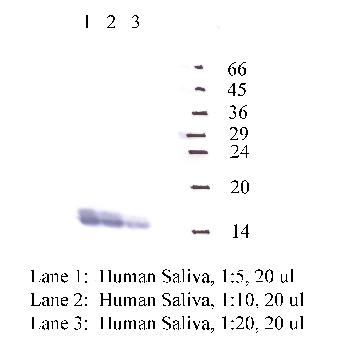 Anti-CSTD Rabbit Polyclonal Antibody