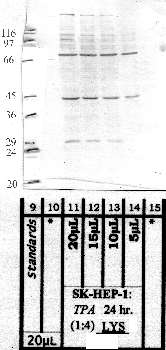 Anti-CPNS1 Rabbit Polyclonal Antibody