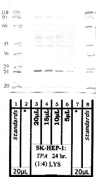 Anti-CPNS1 Rabbit Polyclonal Antibody