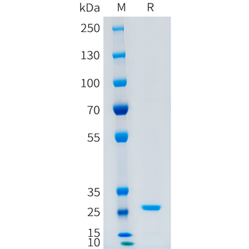 Mouse CD123 Protein, His Tag