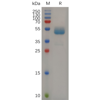 Human LGALS3 Protein, His Tag