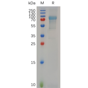 Human IFNAR1 Protein, His Tag