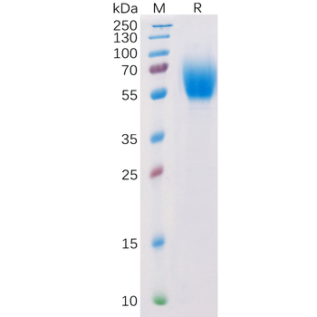 Human IGFBP7 Protein, His Tag