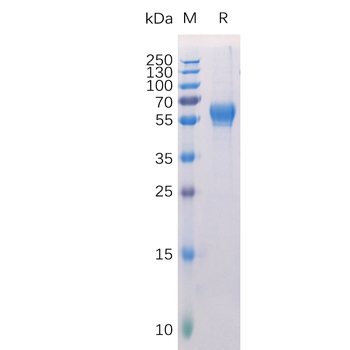 Human TIM1 Protein, His Tag