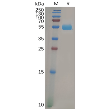 Human IL21 Protein, His Tag