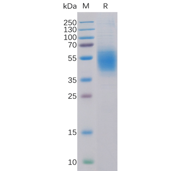Human GUCY2C Protein, His Tag