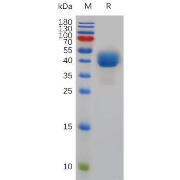 Human IL12B Protein, His Tag