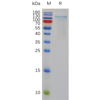 Human CDH6 Protein, His Tag