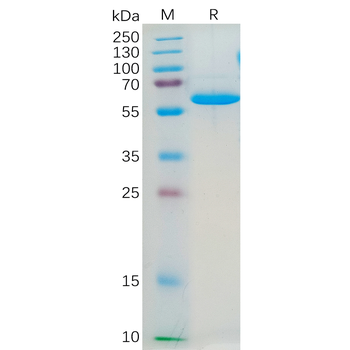 Human ADGRE2 Protein, His Tag