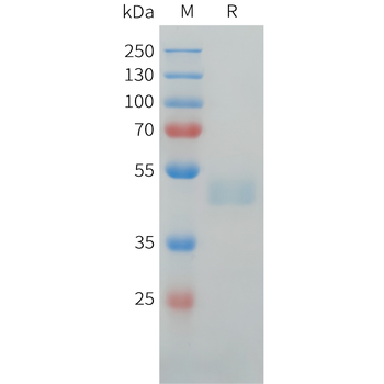 Mouse CCR8 Protein, hFc Tag