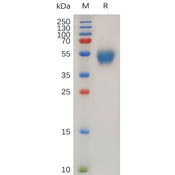Human IL2RG Protein, hFc Tag