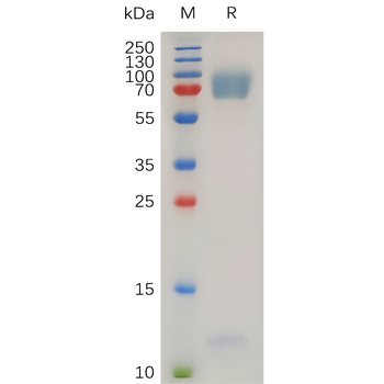 Human CEACAM8 Protein, hFc Tag