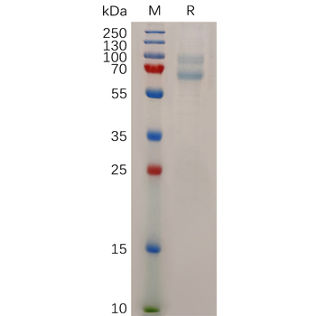 Human TNFRSF1A Protein, hFc Tag